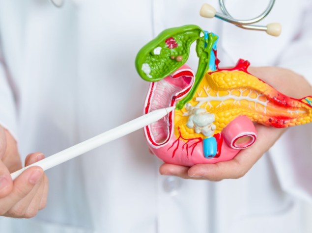 Colangiocarcinoma-pancreas