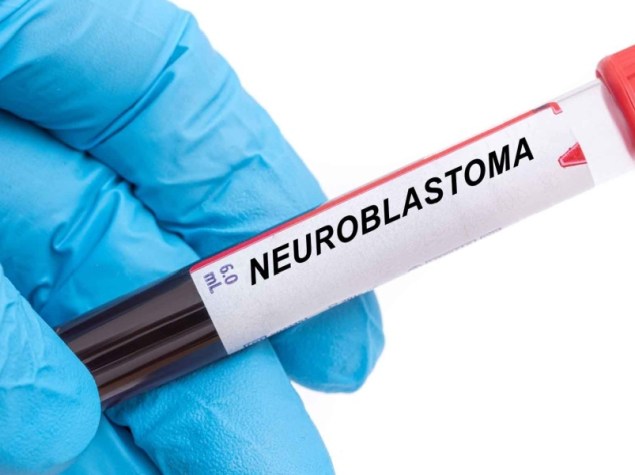 Provetta di sangue per la malattia del neuroblastoma nella mano di un medico