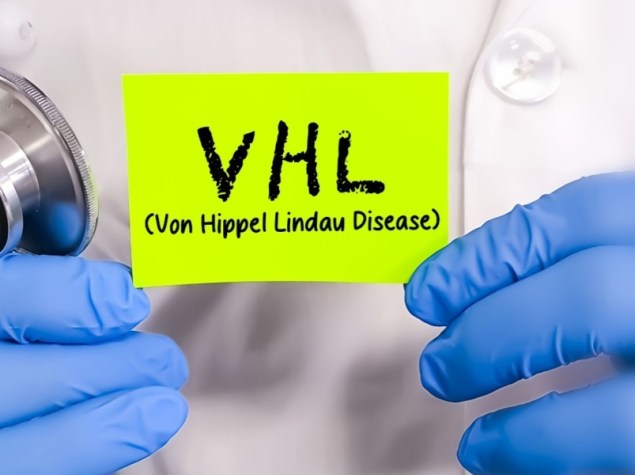 La malattia di Von Hippel Lindau è una malattia ereditaria caratterizzata dalla formazione di tumori e sacche piene di liquido, immagine concettuale medica