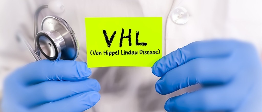 La malattia di Von Hippel Lindau è una malattia ereditaria caratterizzata dalla formazione di tumori e sacche piene di liquido, immagine concettuale medica