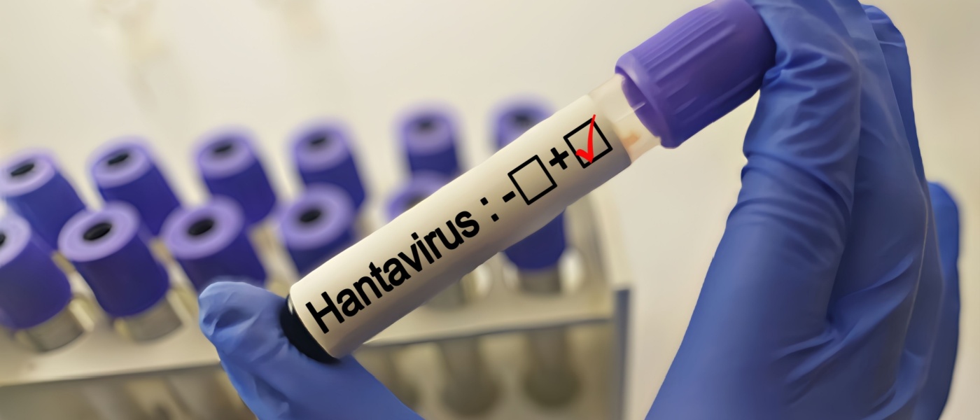 Prelievo di sangue per il test dell'Hantavirus presso un laboratorio medico