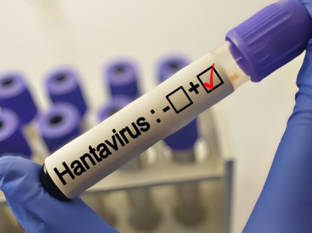 Prelievo di sangue per il test dell'Hantavirus presso un laboratorio medico