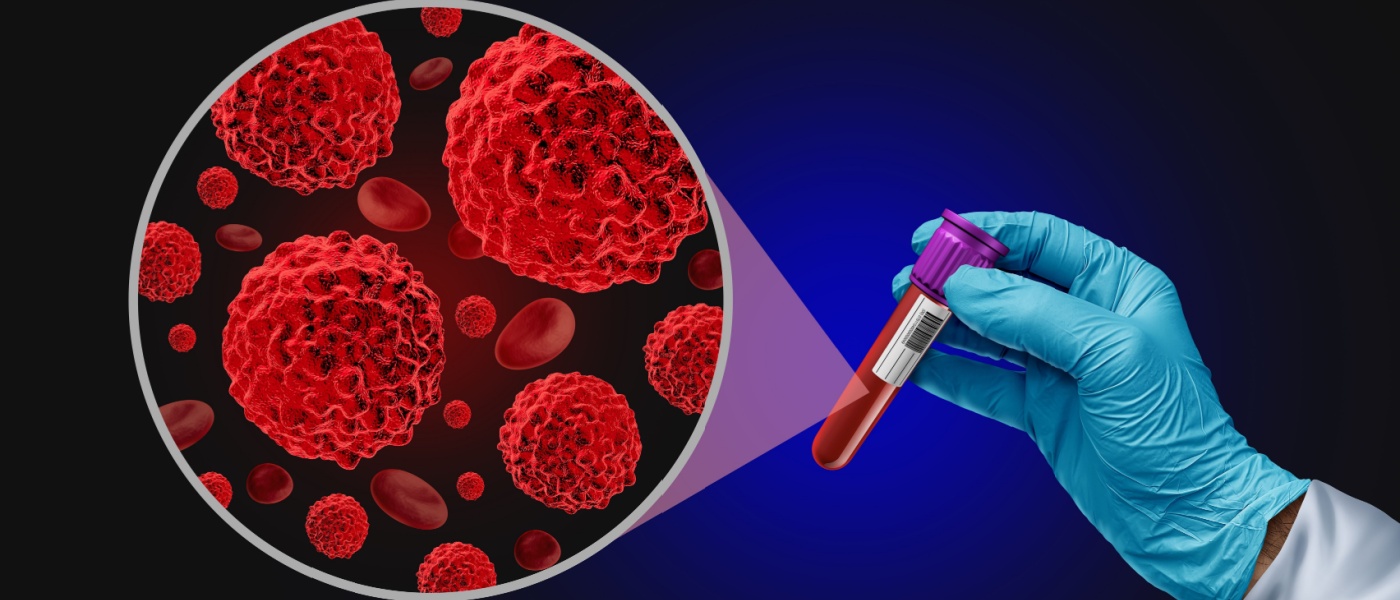 Provetta del sangue per biopsia liquida