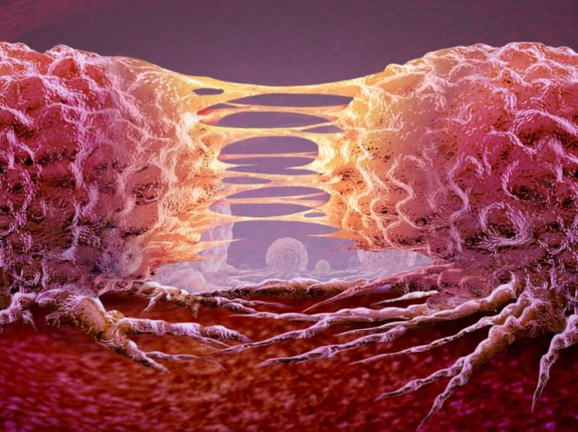 Metastasi, Cellula cancerosa