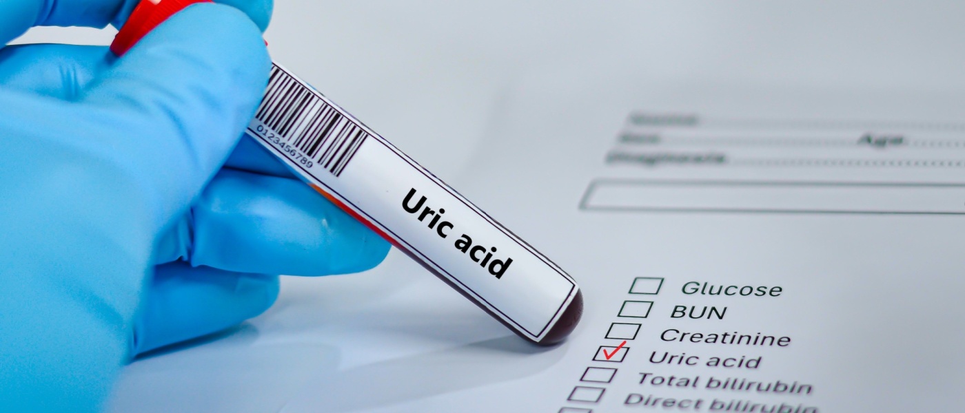 Richiesta di prelievo di sangue in provetta e su carta per l'analisi dell'acido urico