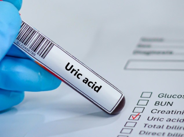 Richiesta di prelievo di sangue in provetta e su carta per l'analisi dell'acido urico