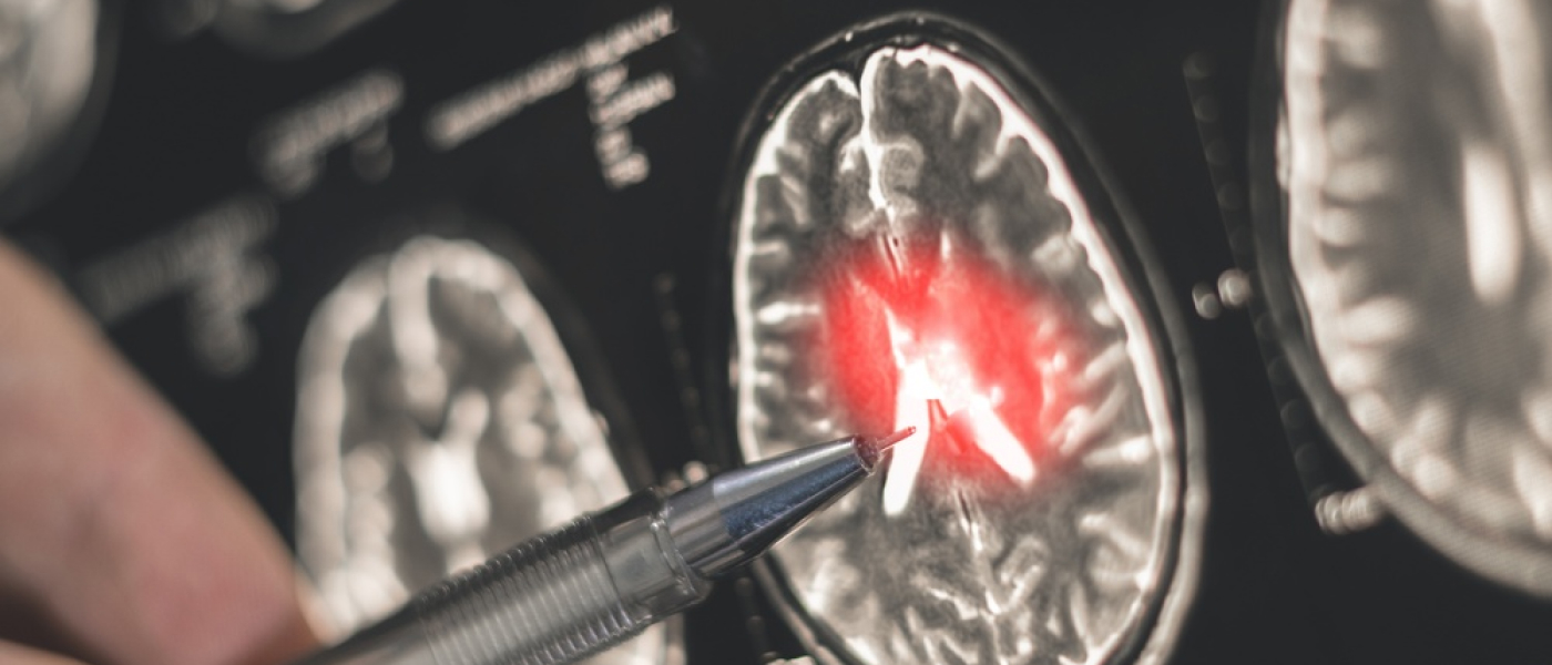 Il medico esamina una radiografia di un cervello umano.