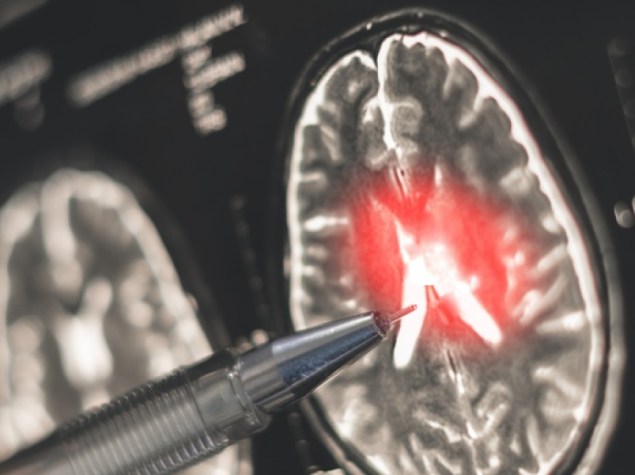Il medico esamina una radiografia di un cervello umano.